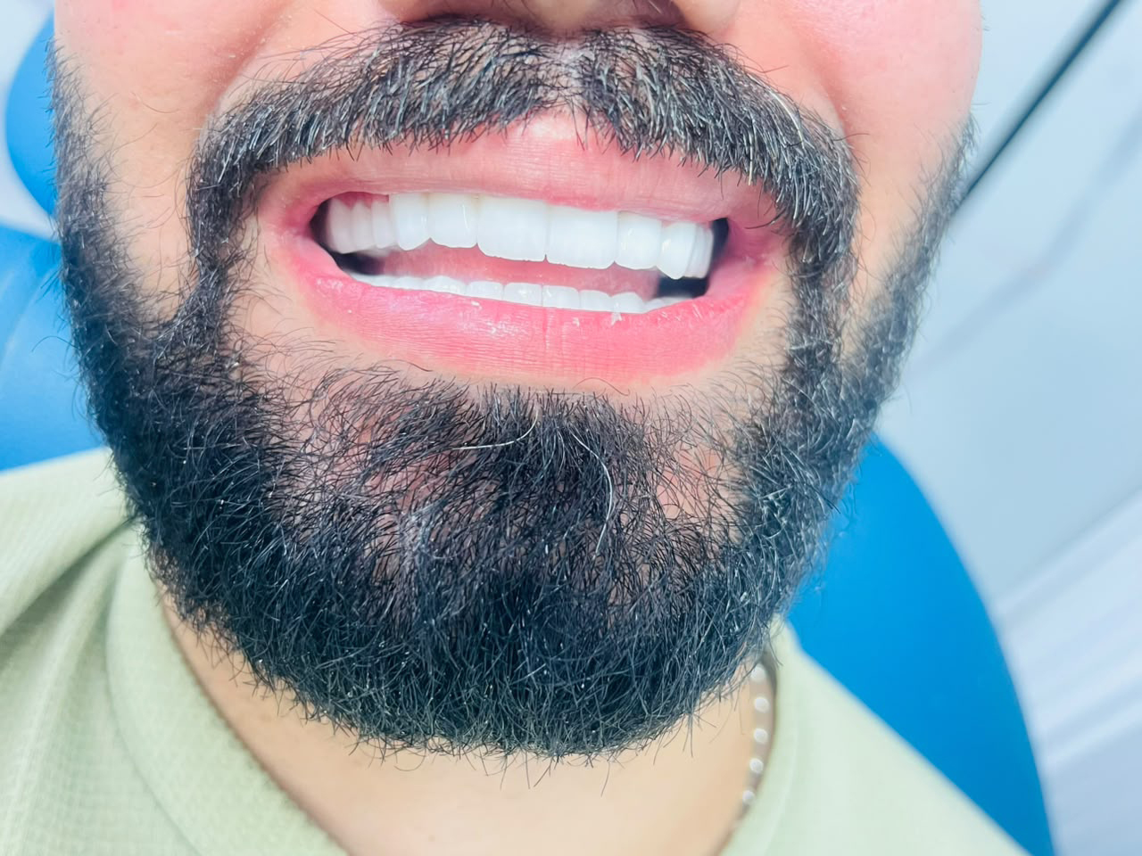 Rident smile